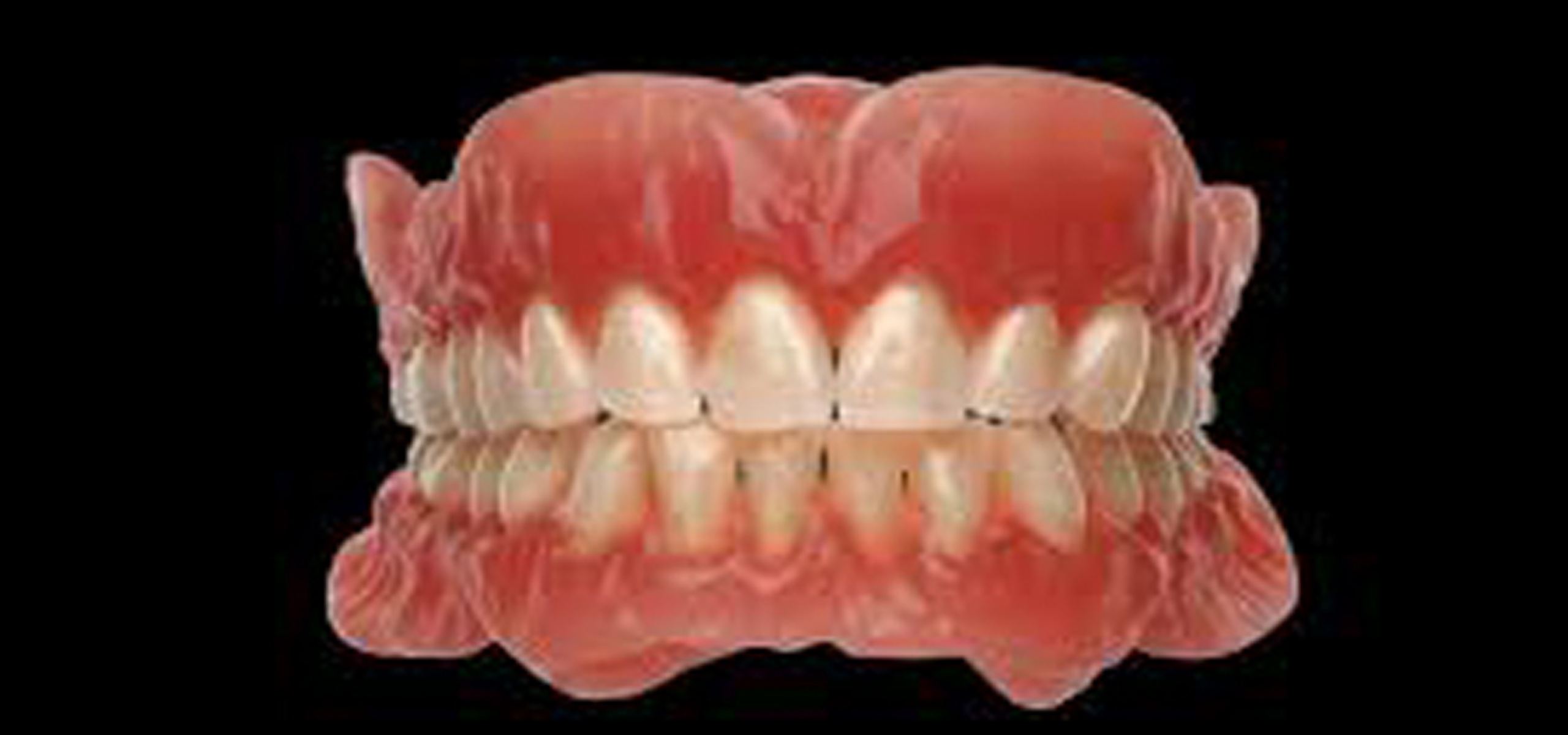 dental treatment in hyderabad 
