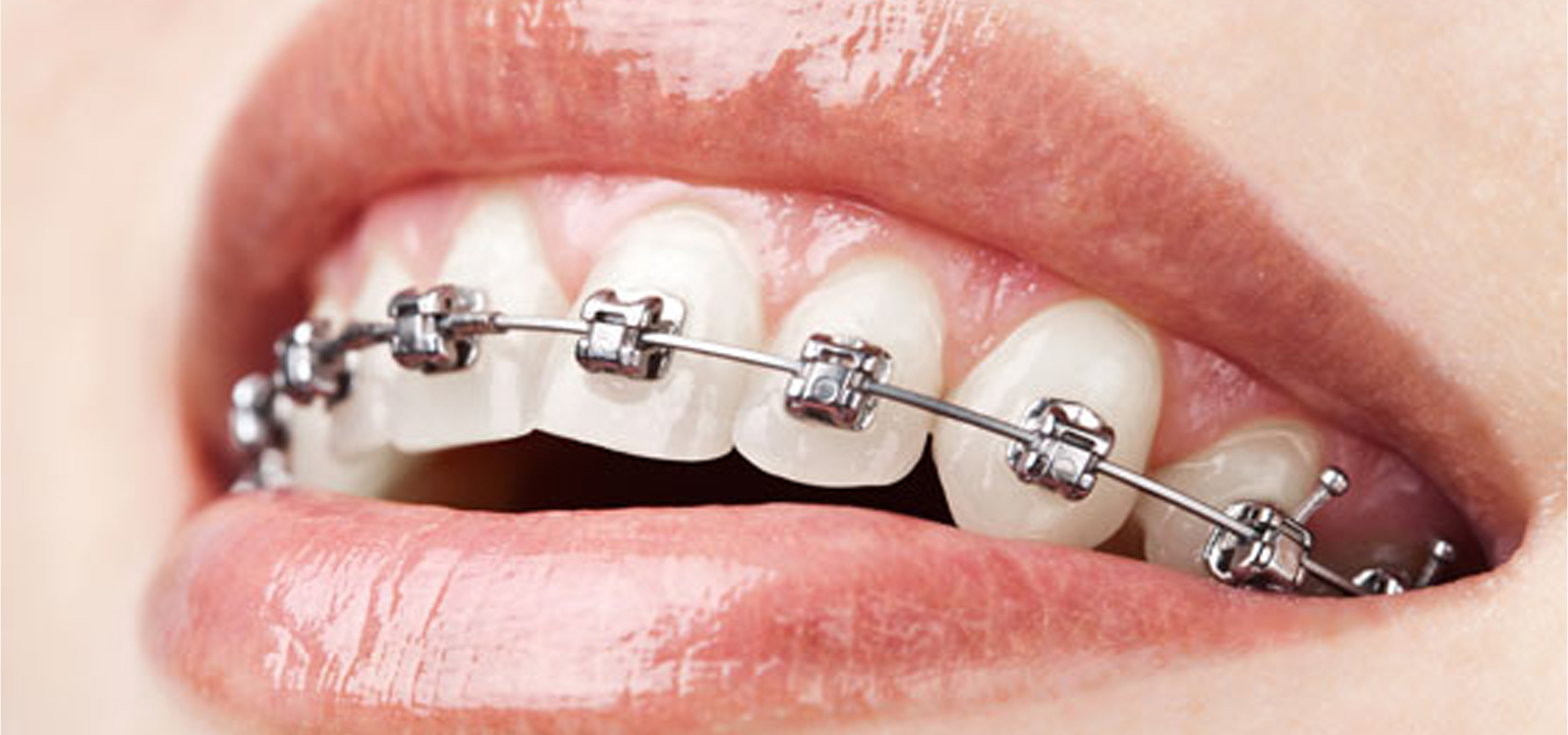  dental hospital in ameerpet 
